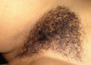 thick hairy bush