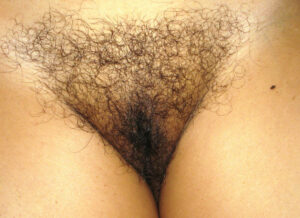 trimmed hairy chut 