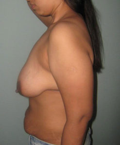 bhabhi nude boobs xx nasty