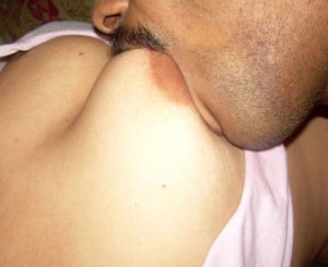 devar sucking nipple xx