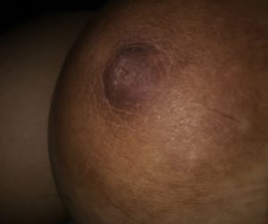 nipple xx hot pic